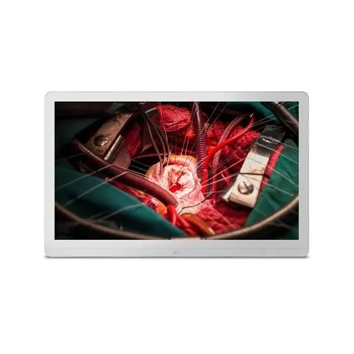 LG 27HJ710S-W 8MP Surgical Monitor price hyderabad